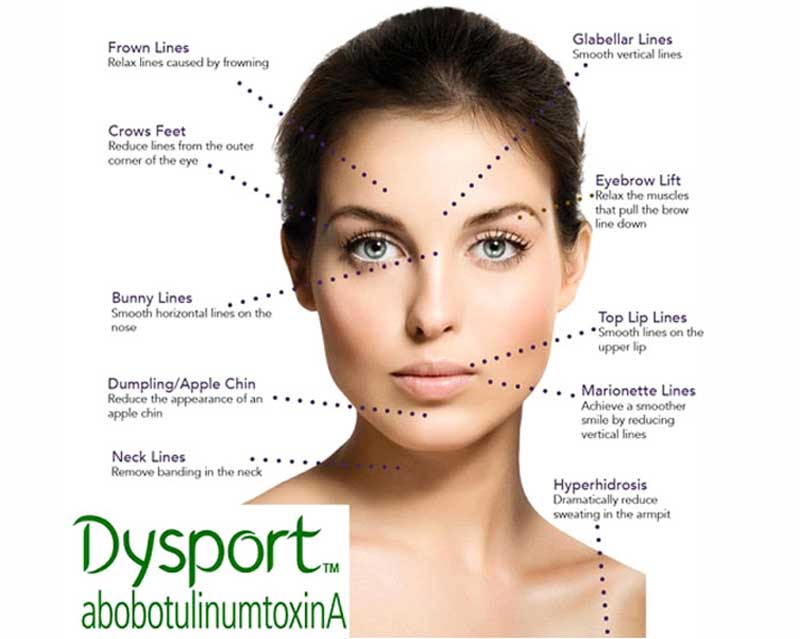 Treat Wrinkles with Dysport in Colleyville, TX | Make You Well Family Practice & Aesthetics